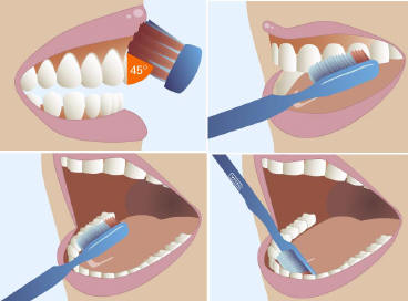 higienes_dentales